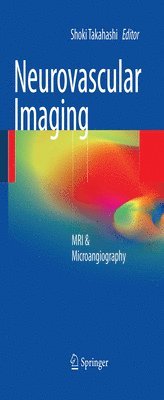 bokomslag Neurovascular Imaging