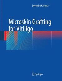 bokomslag Microskin Grafting for Vitiligo