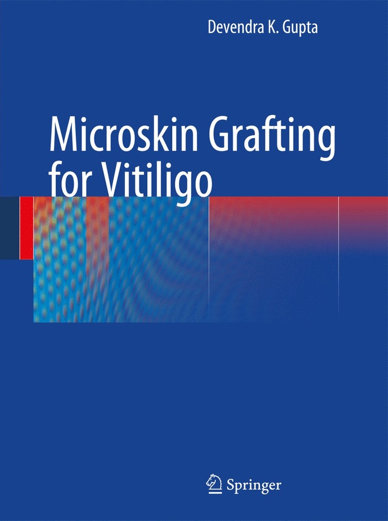 Devendra K. Gupta - Microskin Grafting for Vitiligo, Häftad