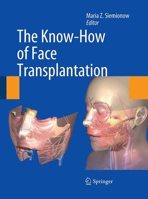 Maria Z. Siemionow - Know-How of Face Transplantation, Häftad