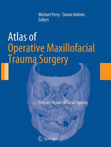 Michael Perry, Simon Holmes - Atlas of Operative Maxillofacial Trauma Surgery, Häftad
