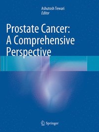 bokomslag Prostate Cancer: A Comprehensive Perspective