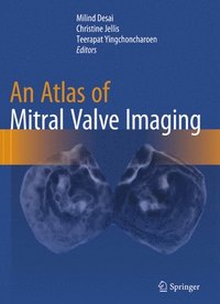 bokomslag An Atlas of Mitral Valve Imaging