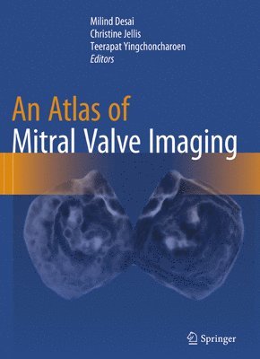 bokomslag An Atlas of Mitral Valve Imaging