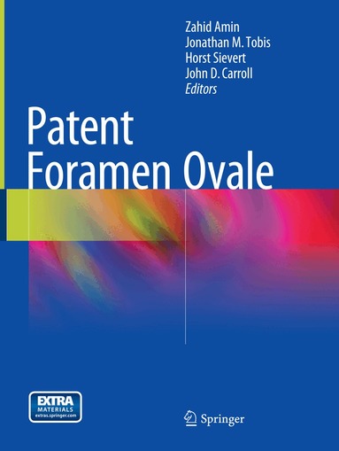 Zahid Amin, Jonathan M. Tobis, Horst Sievert, John D. Carroll - Patent Foramen Ovale, Häftad