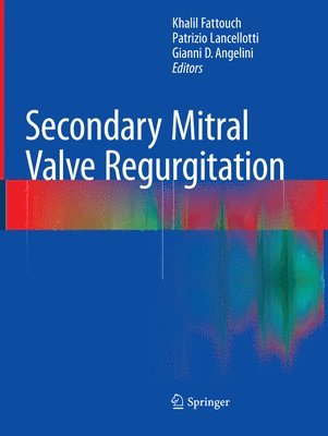 bokomslag Secondary Mitral Valve Regurgitation