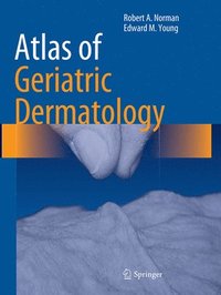 bokomslag Atlas of Geriatric Dermatology