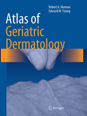 Robert A. Norman, Edward M. Young, Jr, Edward M. Young Jr - Atlas of Geriatric Dermatology, Häftad