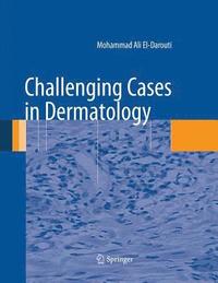 bokomslag Challenging Cases in Dermatology