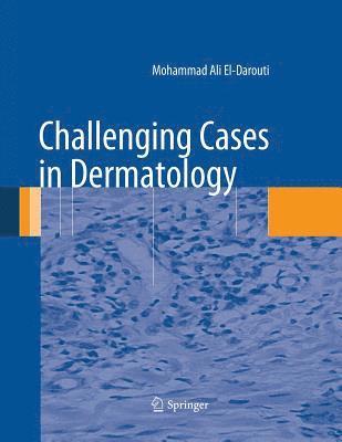 bokomslag Challenging Cases in Dermatology