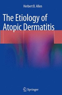 bokomslag The Etiology of Atopic Dermatitis