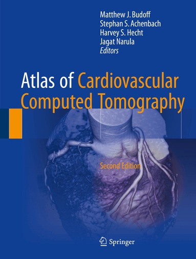 Matthew J. Budoff, Stephan S. Achenbach, Harvey S. Hecht, Jagat Narula - Atlas of Cardiovascular Computed Tomography, Inbunden