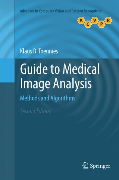 Klaus D. Toennies - Guide to Medical Image Analysis, Häftad