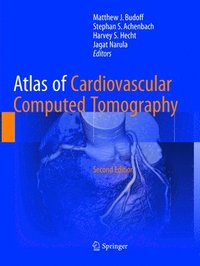 bokomslag Atlas of Cardiovascular Computed Tomography