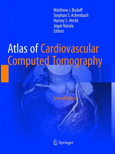 Matthew J. Budoff, Stephan S. Achenbach, Harvey S. Hecht, Jagat Narula - Atlas of Cardiovascular Computed Tomography, Häftad