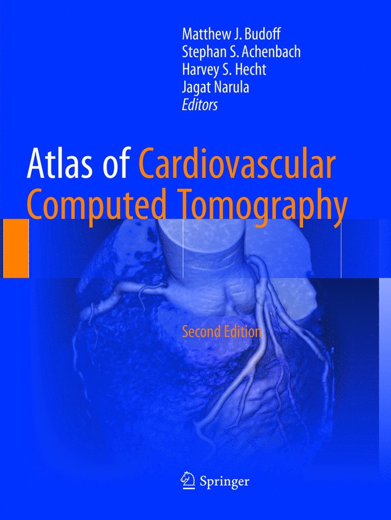 Matthew J. Budoff, Stephan S. Achenbach, Harvey S. Hecht, Jagat Narula - Atlas of Cardiovascular Computed Tomography, Häftad