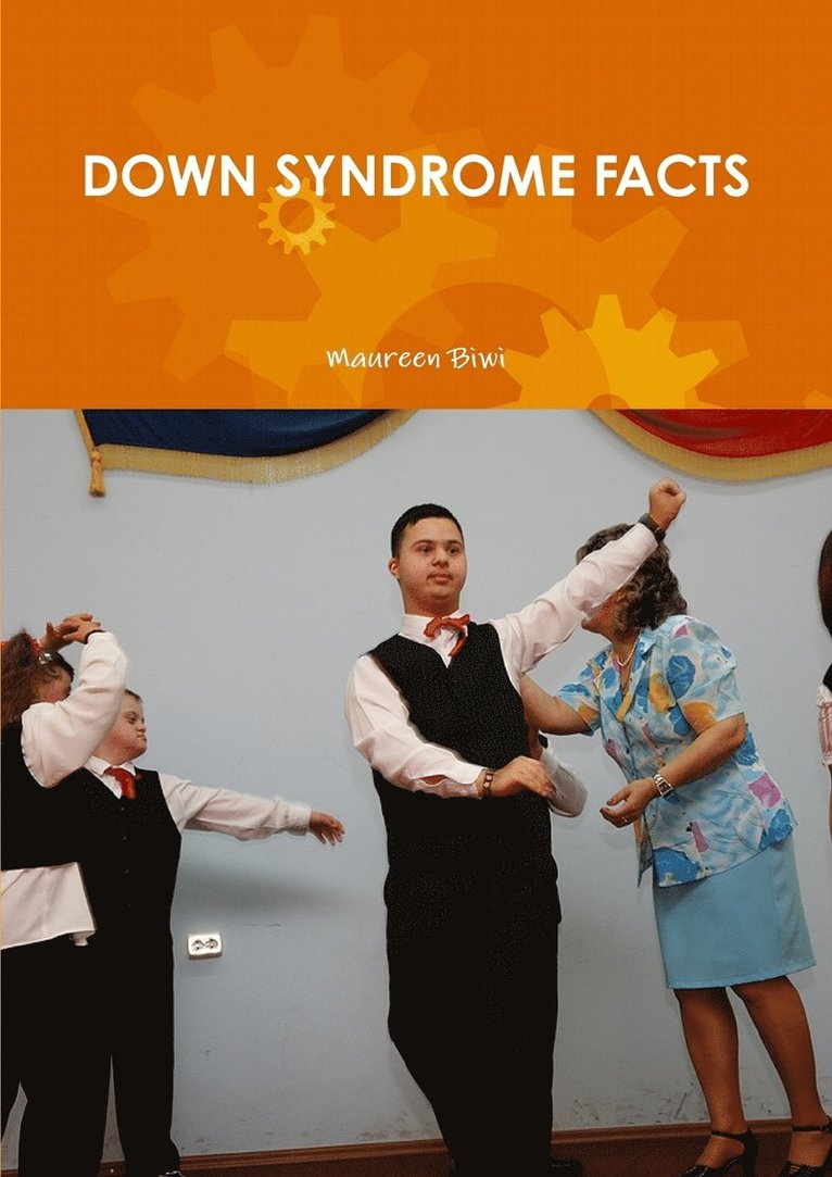 Down Syndrome Facts 1