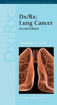 bokomslag Dx/Rx: Lung Cancer