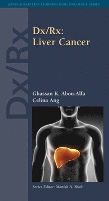 Ghassan K. Abou-Alfa, Celina Ang - DX/Rx: Liver Cancer: ., Häftad
