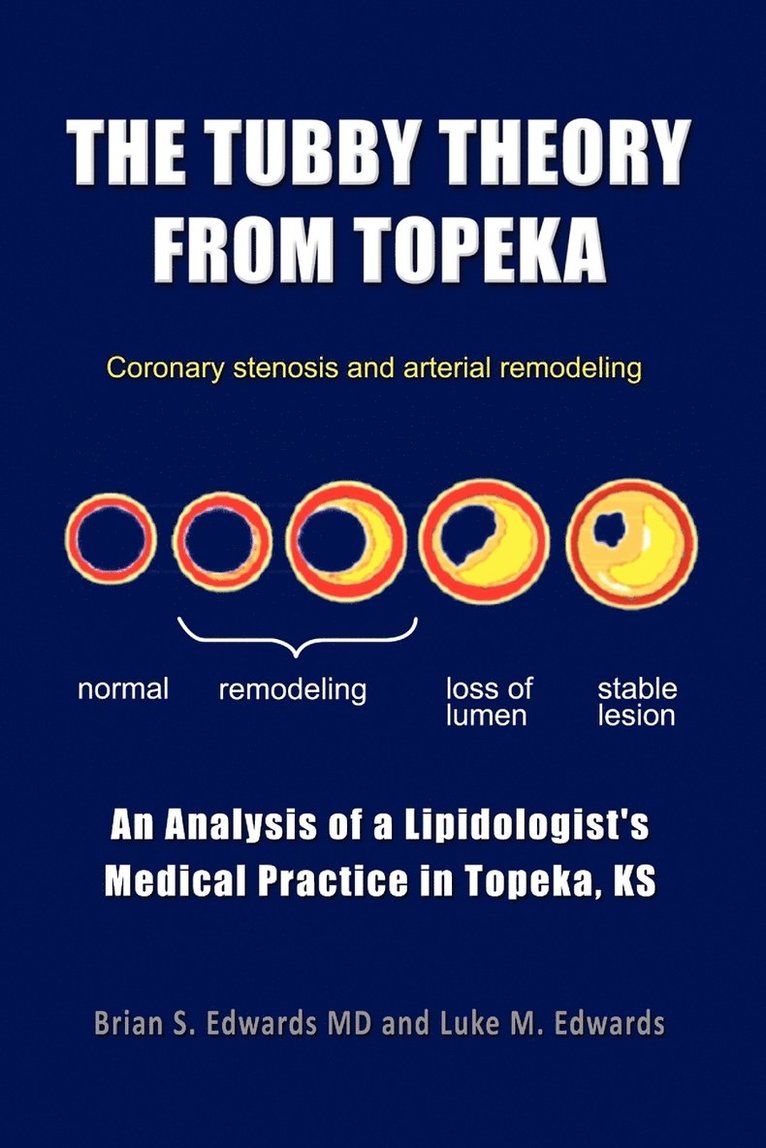 The Tubby Theory from Topeka 1