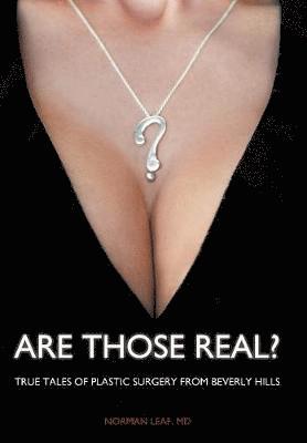 Are Those Real? 1