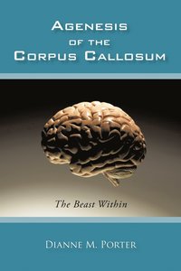 bokomslag Agenesis of the Corpus Callosum
