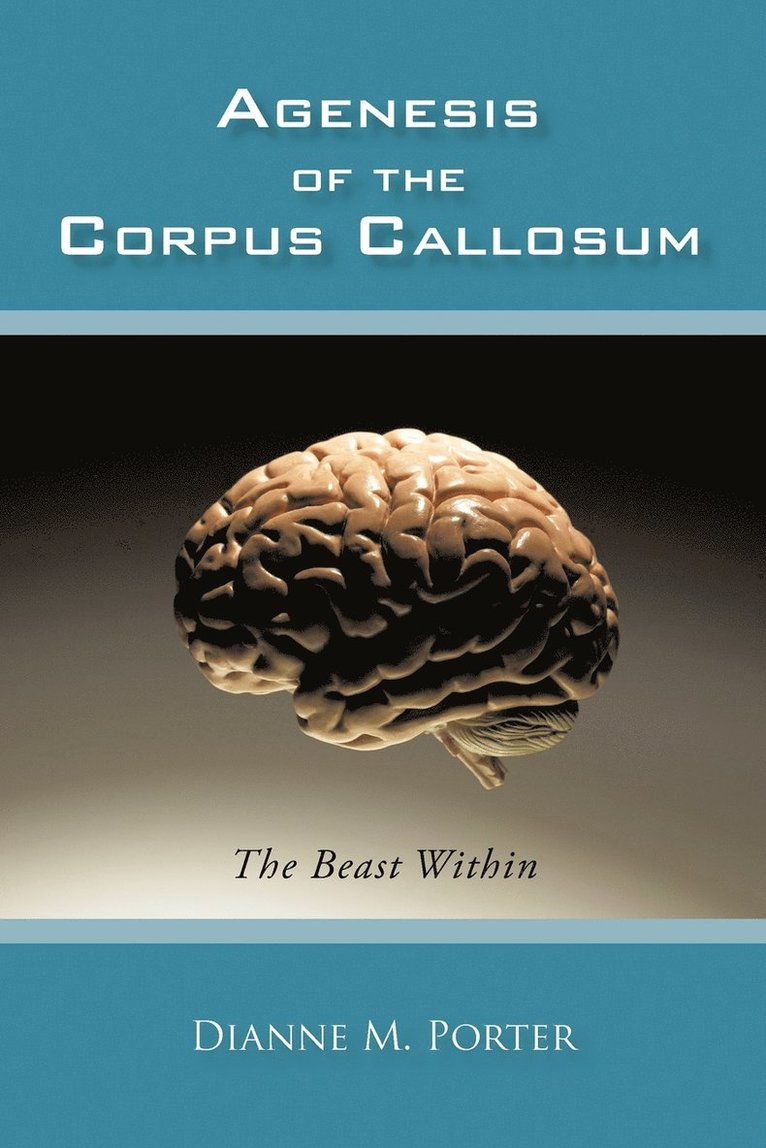 Agenesis of the Corpus Callosum 1