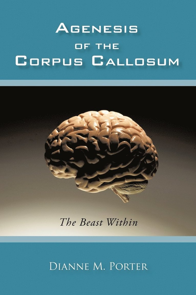 Dianne M Porter, Dianne M. Porter - Agenesis of the Corpus Callosum, Häftad