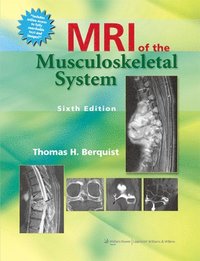 bokomslag MRI of the Musculoskeletal System