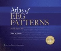 bokomslag Atlas of EEG Patterns