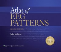 bokomslag Atlas of EEG Patterns