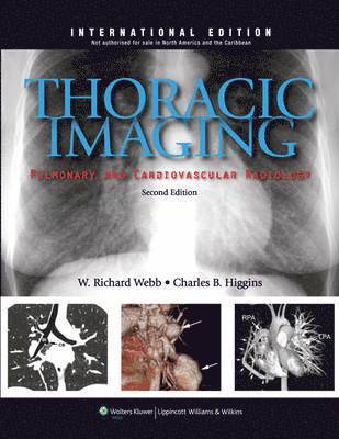 bokomslag Thoracic Imaging: Pulmonary and Cardiovascular Radiology