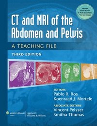 bokomslag CT & MRI of the Abdomen and Pelvis