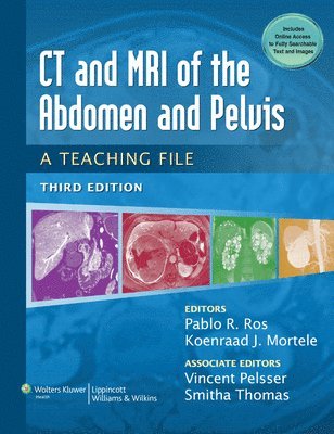 Pablo R. Ros, Koenraad J. Mortele - CT & MRI of the Abdomen and Pelvis : A Teaching File, Inbunden