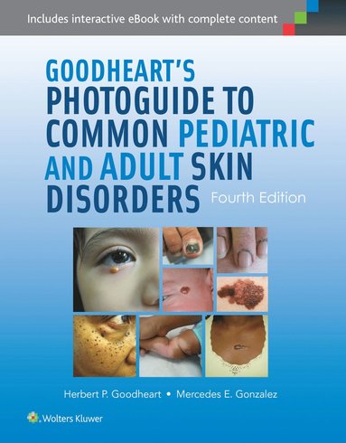 bokomslag Goodheart's Photoguide to Common Pediatric and Adult Skin Disorders