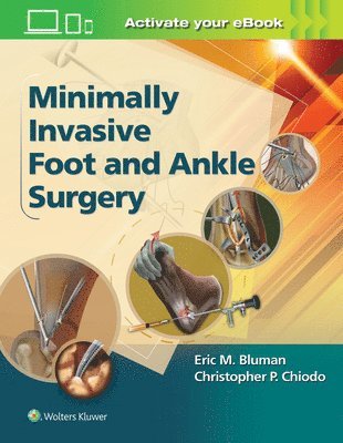 Eric M. Bluman, Christopher Chiodo - Minimally Invasive Foot & Ankle Surgery, Inbunden