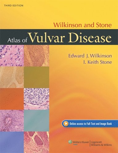 bokomslag Wilkinson and Stone Atlas of Vulvar Disease