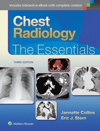 bokomslag Chest Radiology: The Essentials