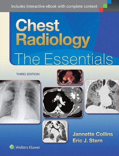 bokomslag Chest Radiology: The Essentials