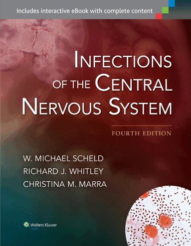 W. Michael Scheld, Richard J. Whitley, Christina M. Marra - Infections of the Central Nervous System, Inbunden