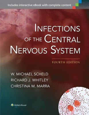 Infections of the Central Nervous System 1