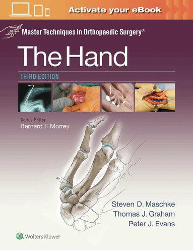 Steven Maschke, Thomas J. Graham, Peter Evans - Master Techniques in Orthopaedic Surgery: The Hand, Inbunden