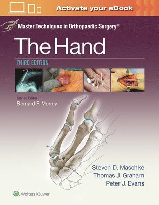 Master Techniques in Orthopaedic Surgery: The Hand 1