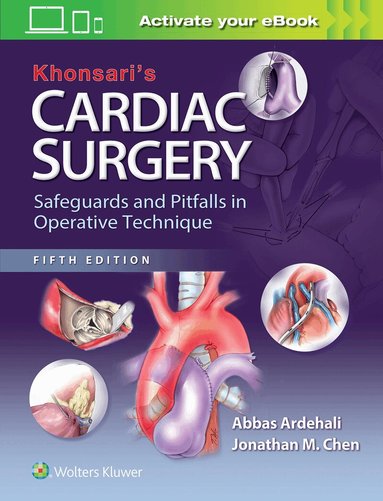 Abbas Ardehali, Jonathan M. Chen - Khonsari's Cardiac Surgery: Safeguards and Pitfalls in Operative Technique, Inbunden