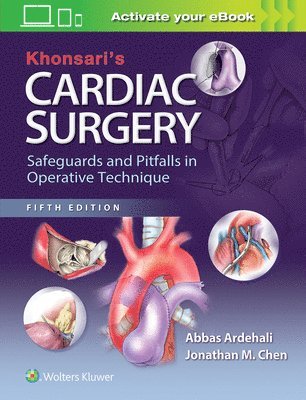 Khonsari's Cardiac Surgery: Safeguards and Pitfalls in Operative Technique 1