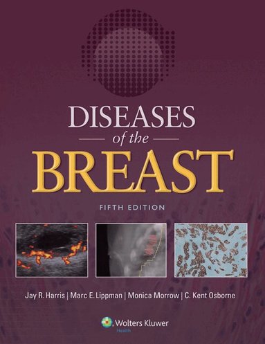 Jay R. Harris, Jay R. Harris, Marc E. Lippman, Monica Morrow, C. Kent Osborne - Diseases of the Breast 5e, Inbunden