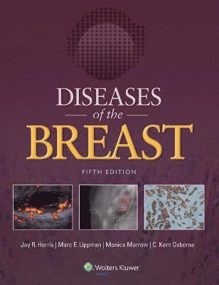 Diseases of the Breast 5e 1