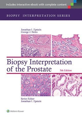 bokomslag Biopsy Interpretation of the Prostate