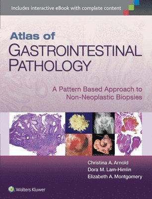 Atlas of Gastrointestinal Pathology : A Pattern Based Approach to Non-Neoplastic Biopsies