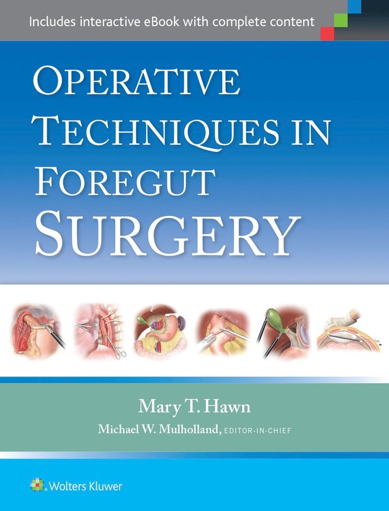 Operative Techniques in Foregut Surgery 1